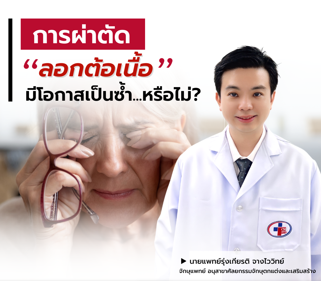 11.24112022 การผ่าตัดลอกต้อเนื้อ มีโอกาสเป็นซ้ำได้หรือไม่.png